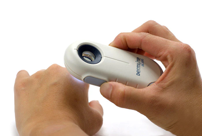 Dermatoscope Dermlite® DL-100 Pocket Epiluminescence Microscopy by 3Gen, LLC  ID DL100